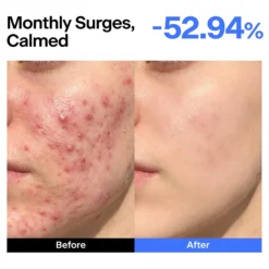ABC Triple-synergy Redness Comfort Serum