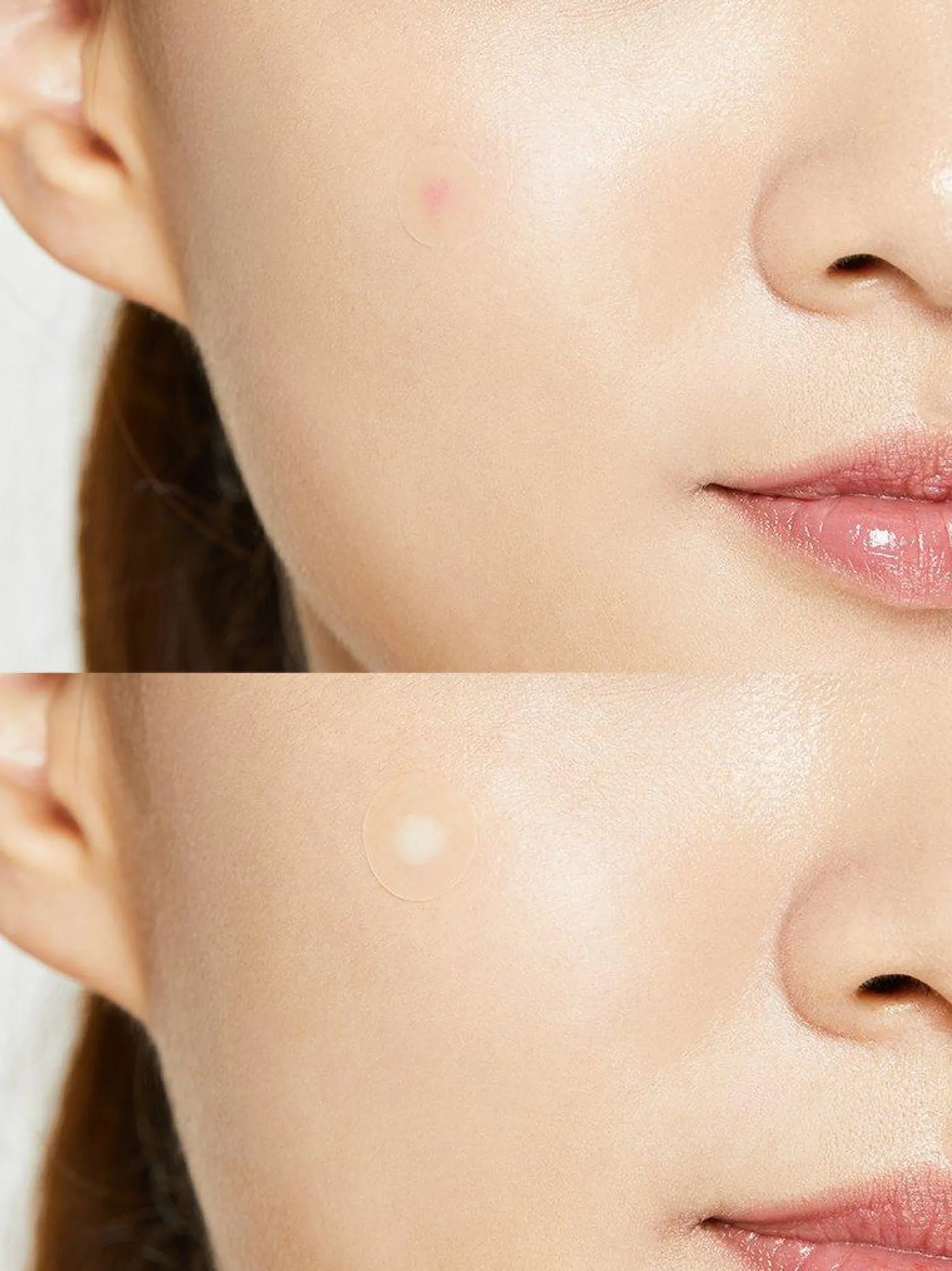 Acne Pimple Master Patch Original Fit