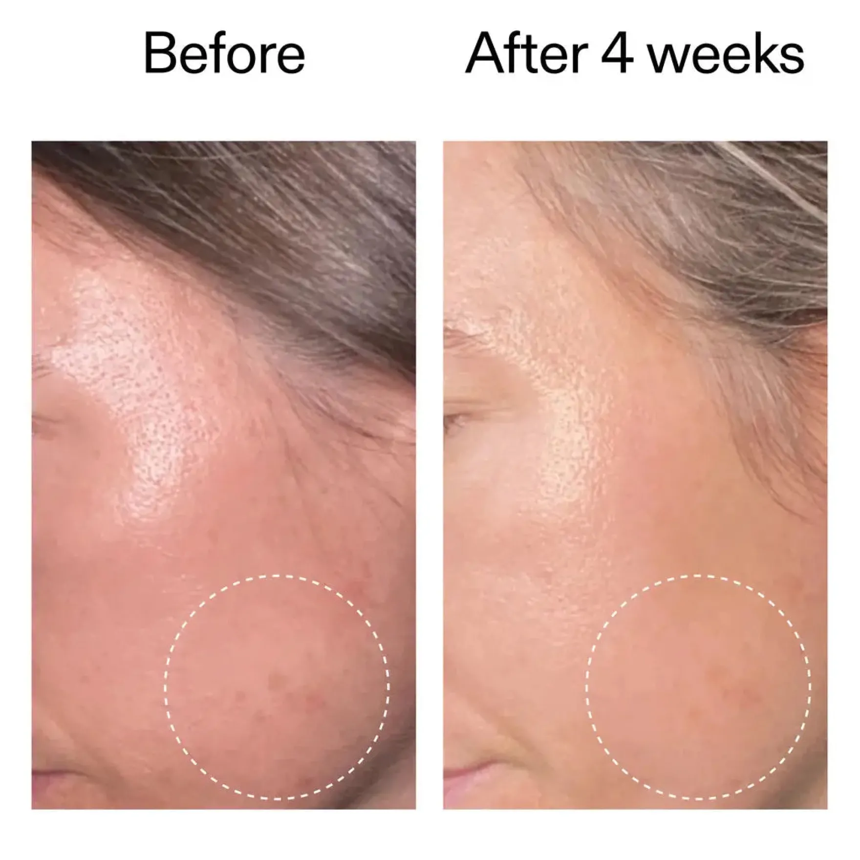 Advanced Retinoid Serum