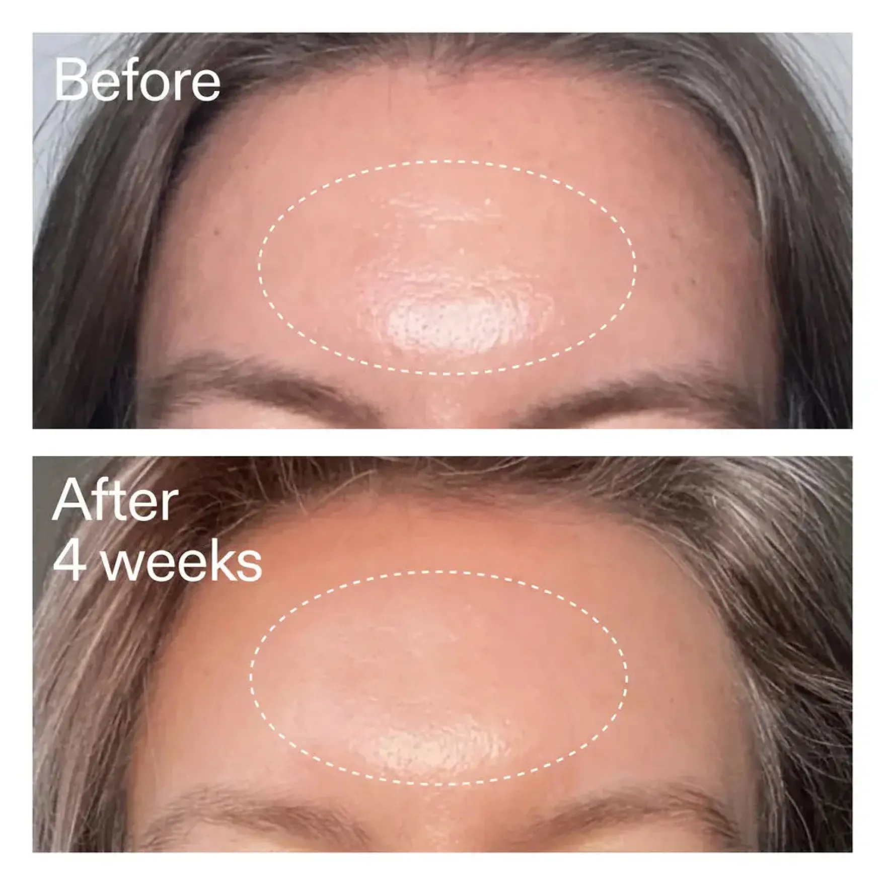 Advanced Retinoid Serum