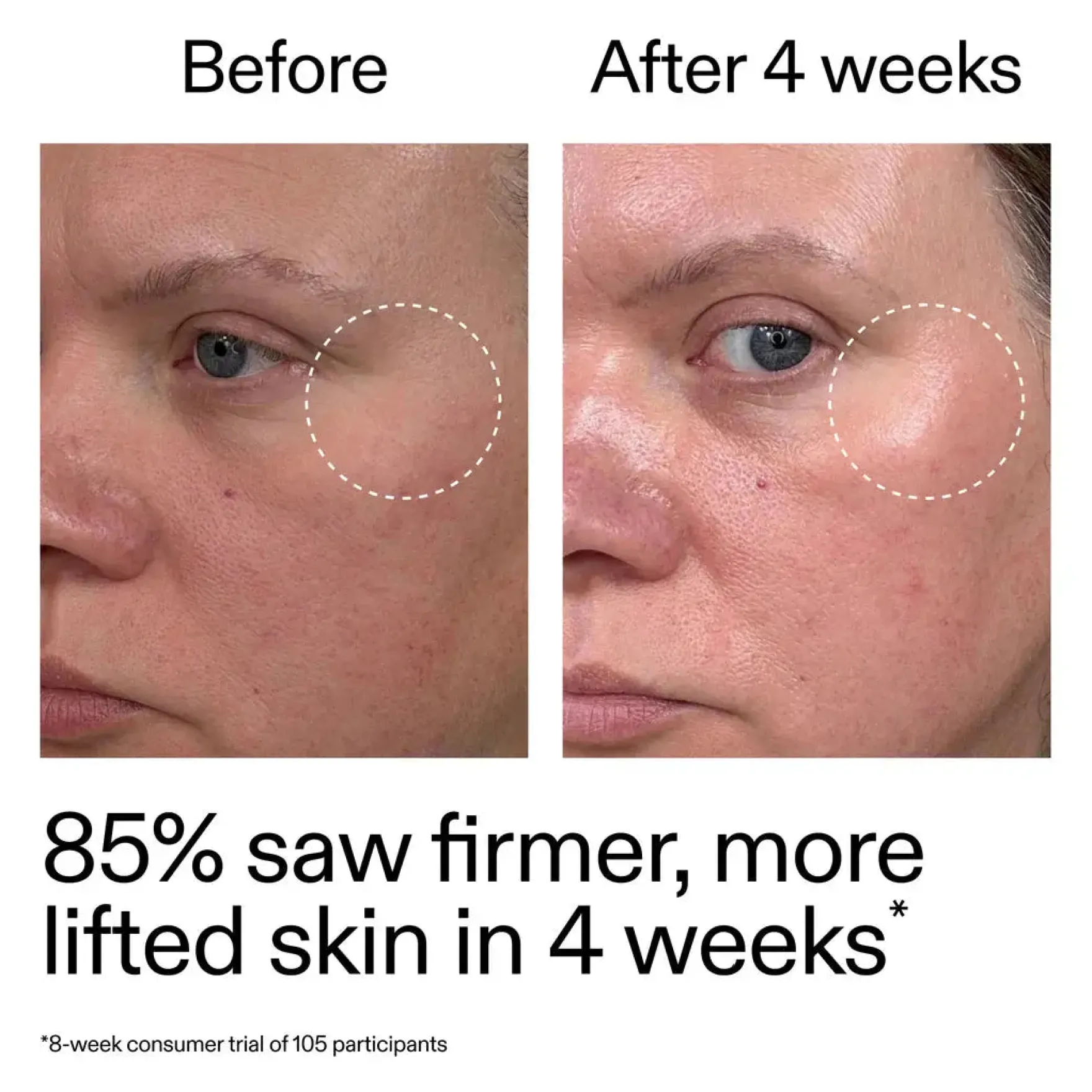 Advanced Retinoid Serum