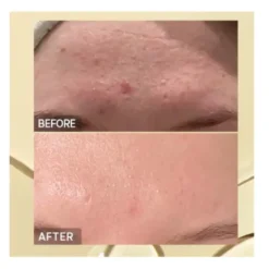 Advanced Snail96 Mucin Power Essence
