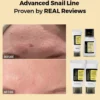 All About Advanced Snail Kit