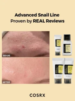 All About Advanced Snail Kit