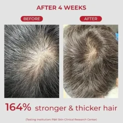 Annurcatin Shampoo