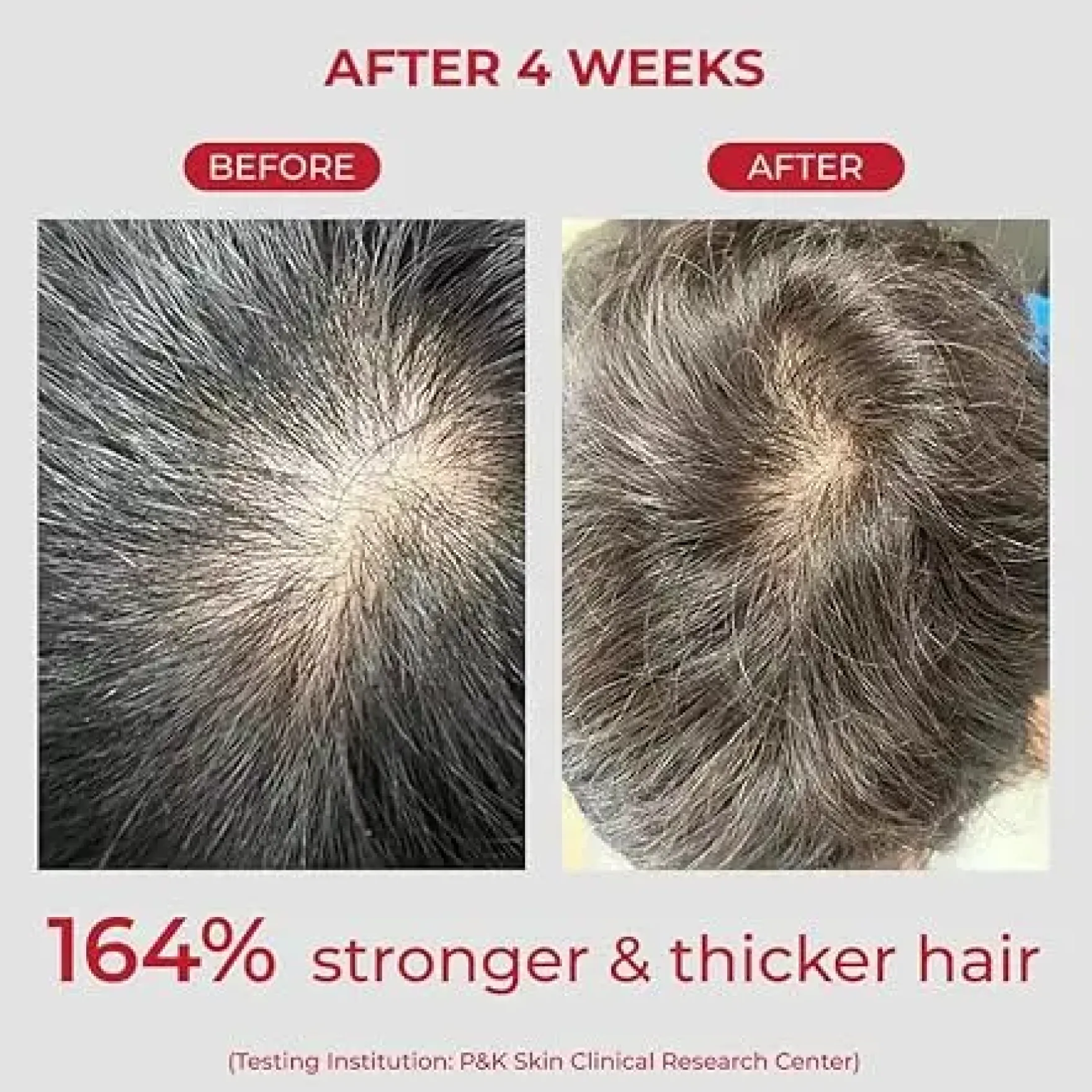 Annurcatin Shampoo