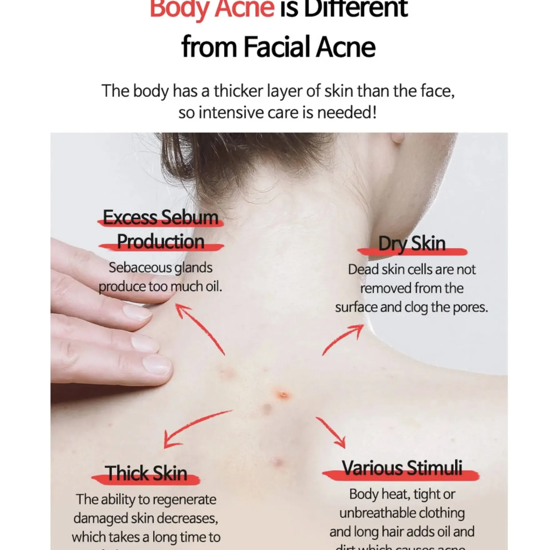 Anti-blemish Body Lotion