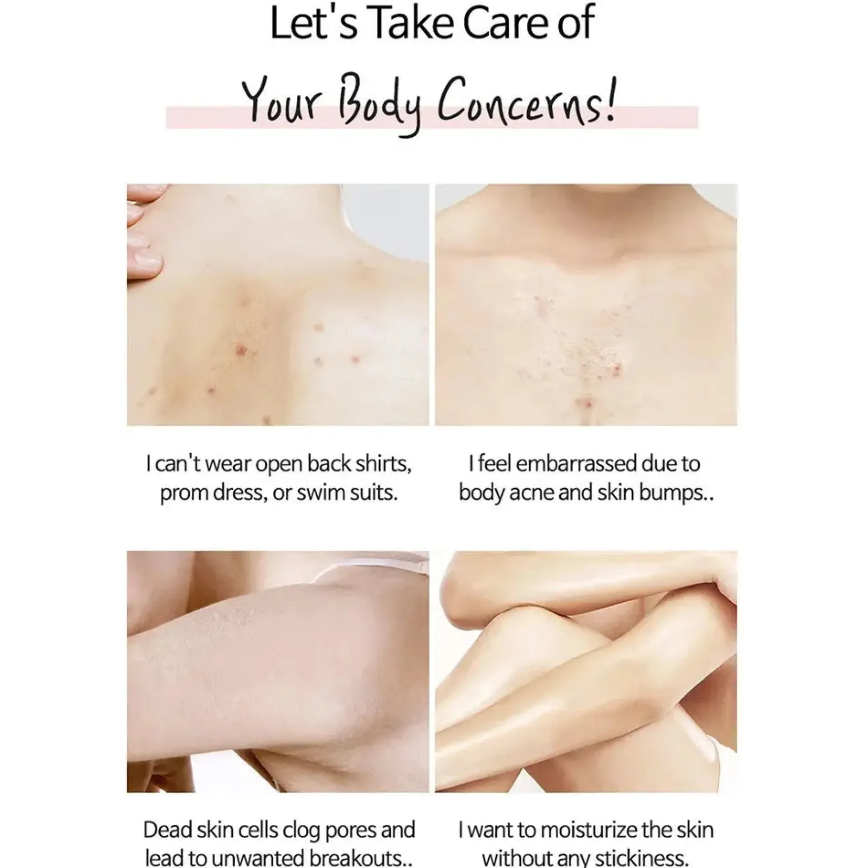 Anti-blemish Body Lotion
