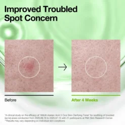 Azelaic Acid 3 Cica Skin Clarifying Toner