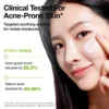 Azelaic Acid Cica Skin Soothing Moisturizer