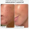 BHA Liquid Exfoliant 30 ml.
