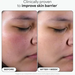 BHA Liquid Exfoliant 30 ml.