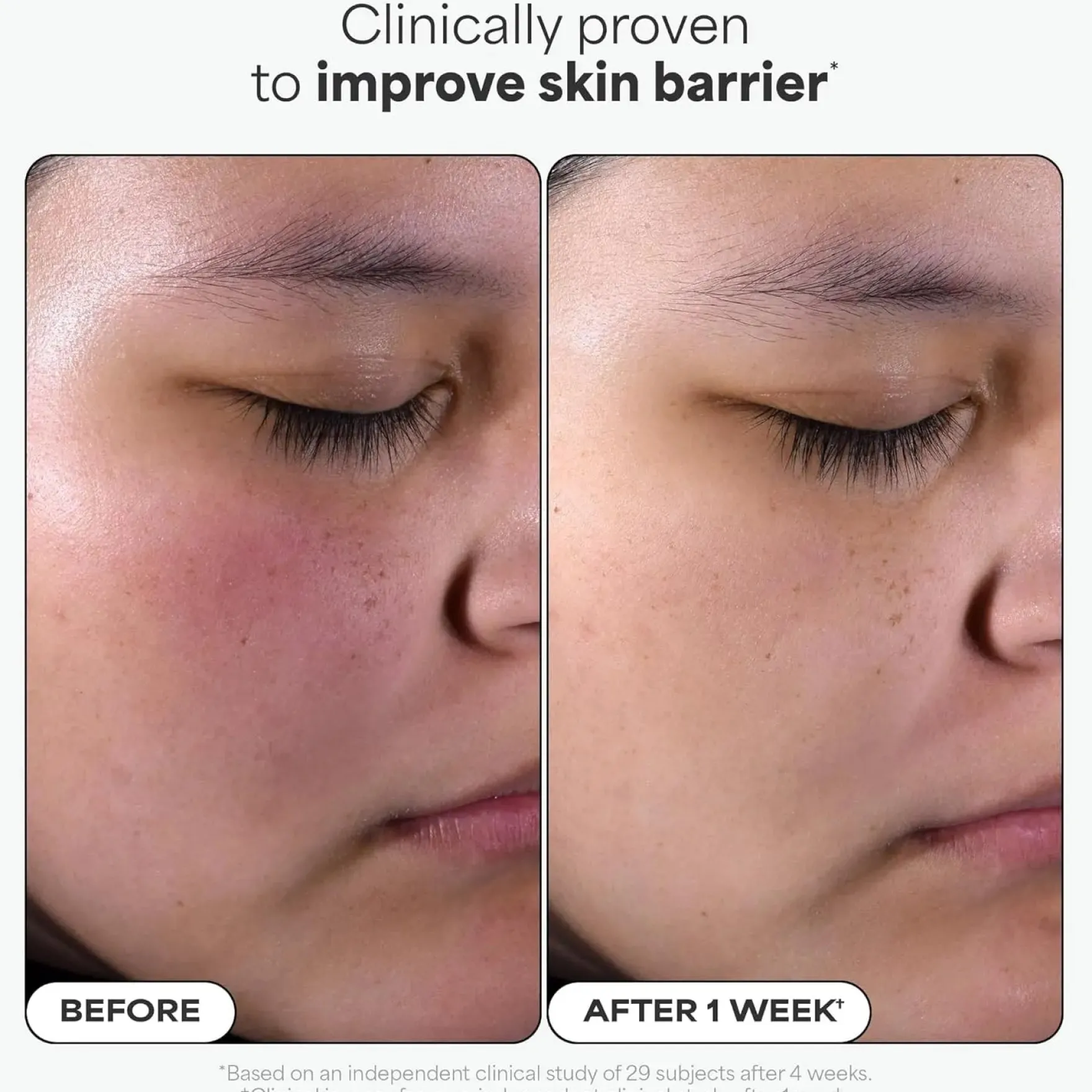 BHA Liquid Exfoliant