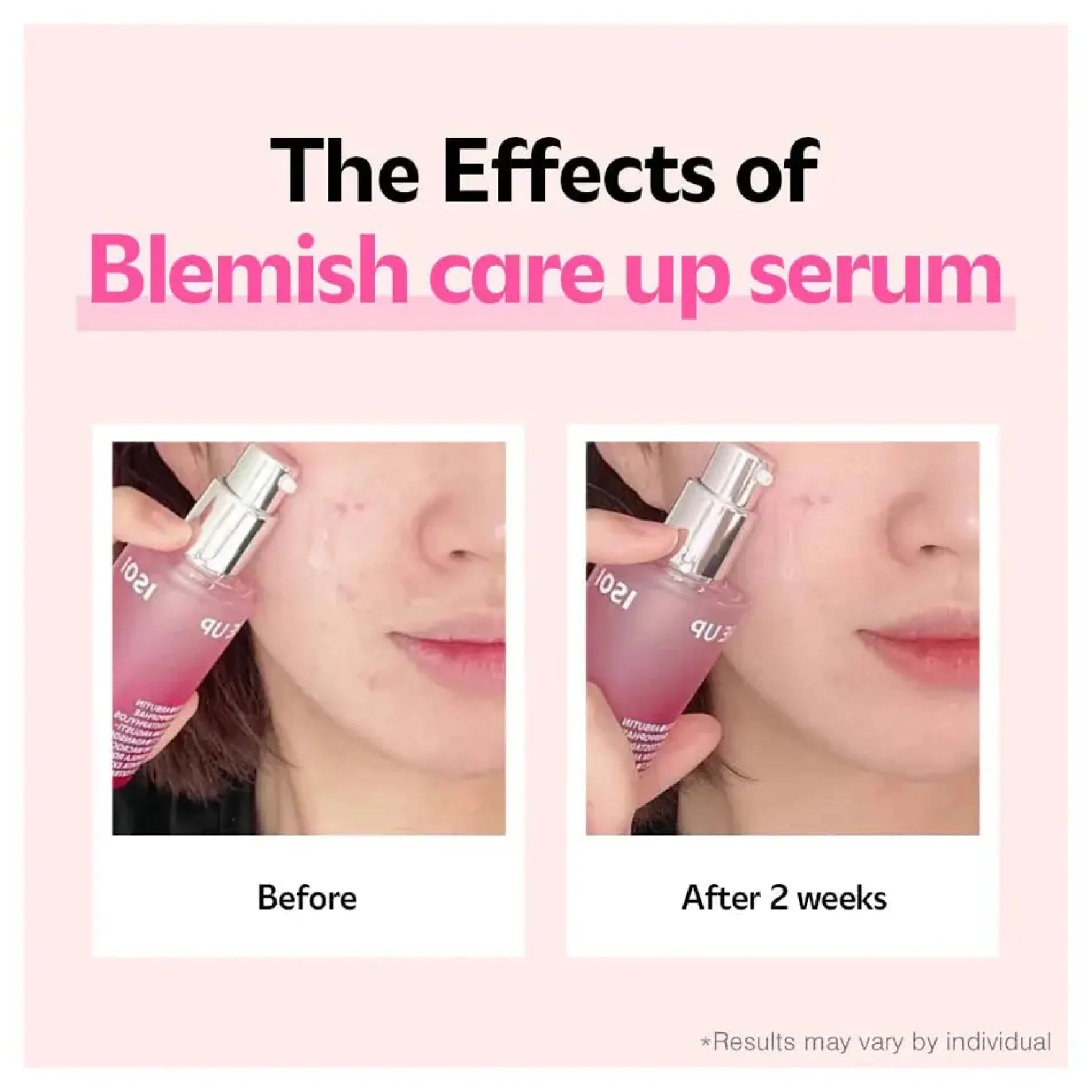 Blemish Care Up Serum