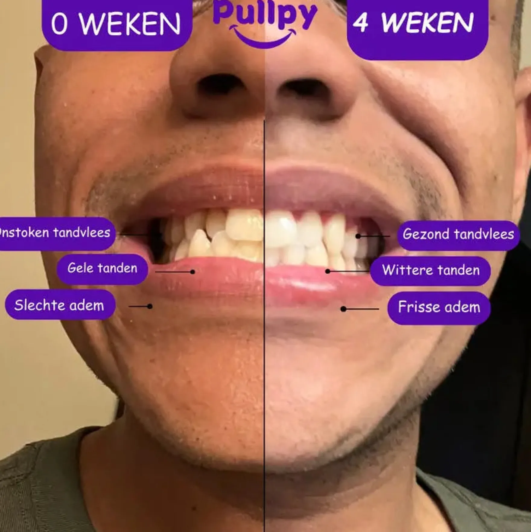 Coco Munt Oil Pulling Mondspoeling