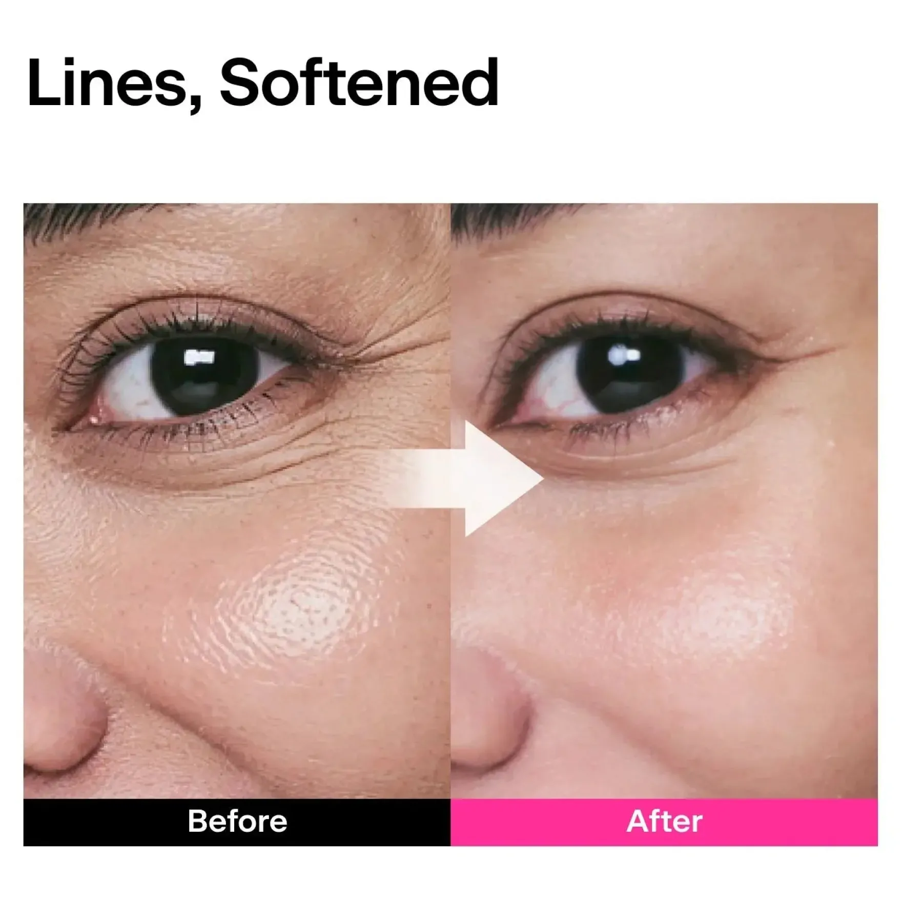 CPR Triple-synergy Wrinkle Care Serum