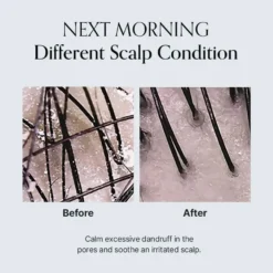 Damage Therapy Scalp Scaling Ampoule