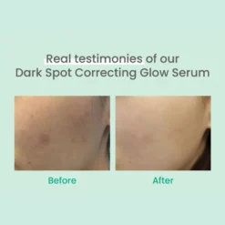 Dark Spot Correcting Glow Serum 20 ml