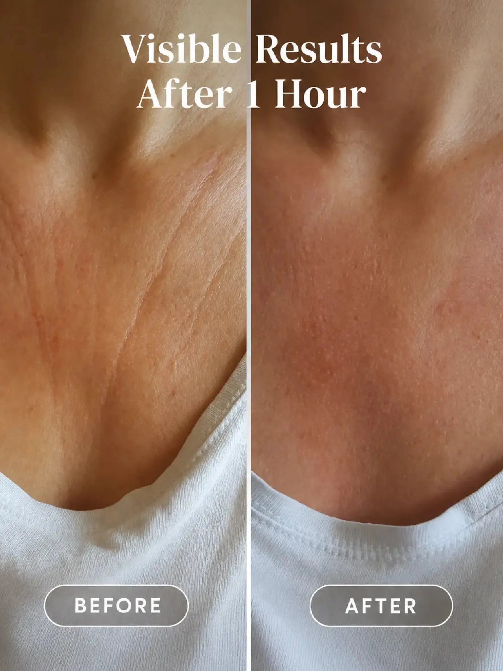 Décolleté Pad Hyaluron