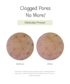 Deep Pore Cleansing Soda Foam