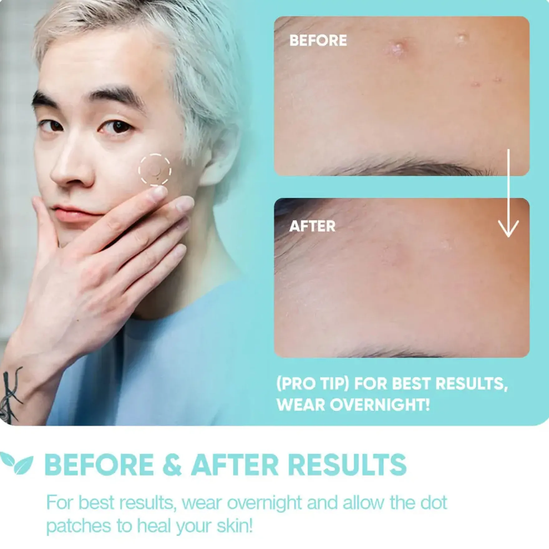 Emergency Dots For Spots and Blemishes Tea Tree Oil