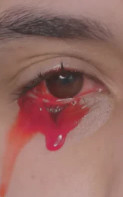 Eyeblood
