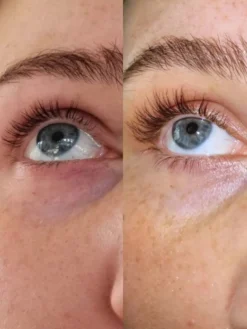 Eyelash Growth Serum