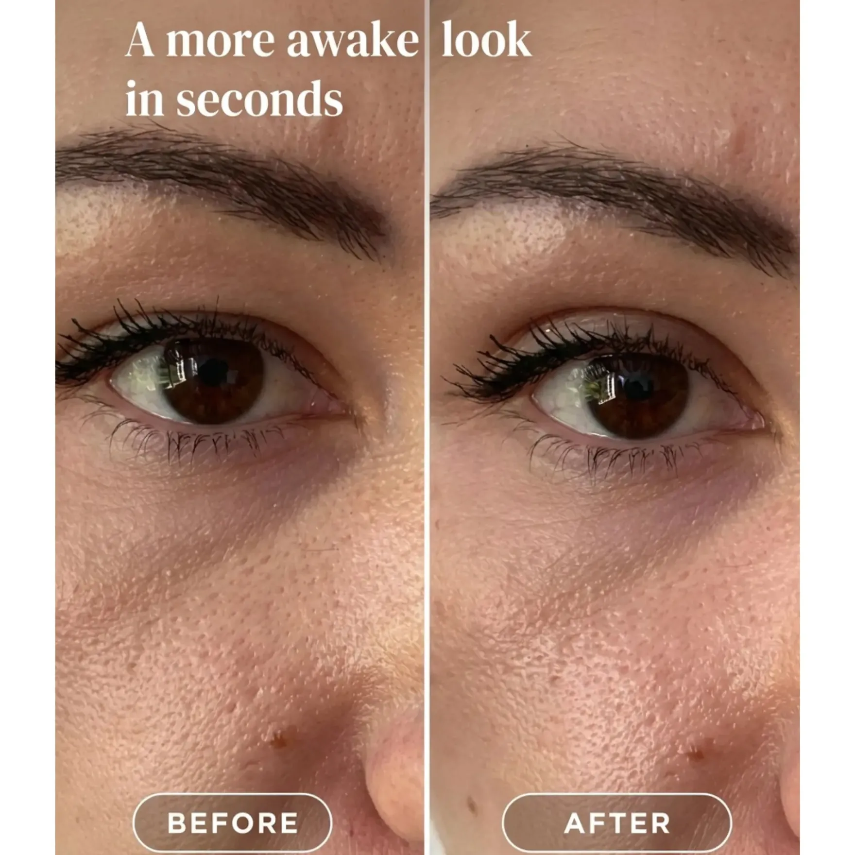 Eyelid Lifting Tapes