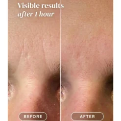 Facial Patches Niacinamide