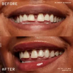 Fat Oil Lip Drip Newsfeed