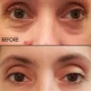 Fermentation Peptine Eye Care Cream