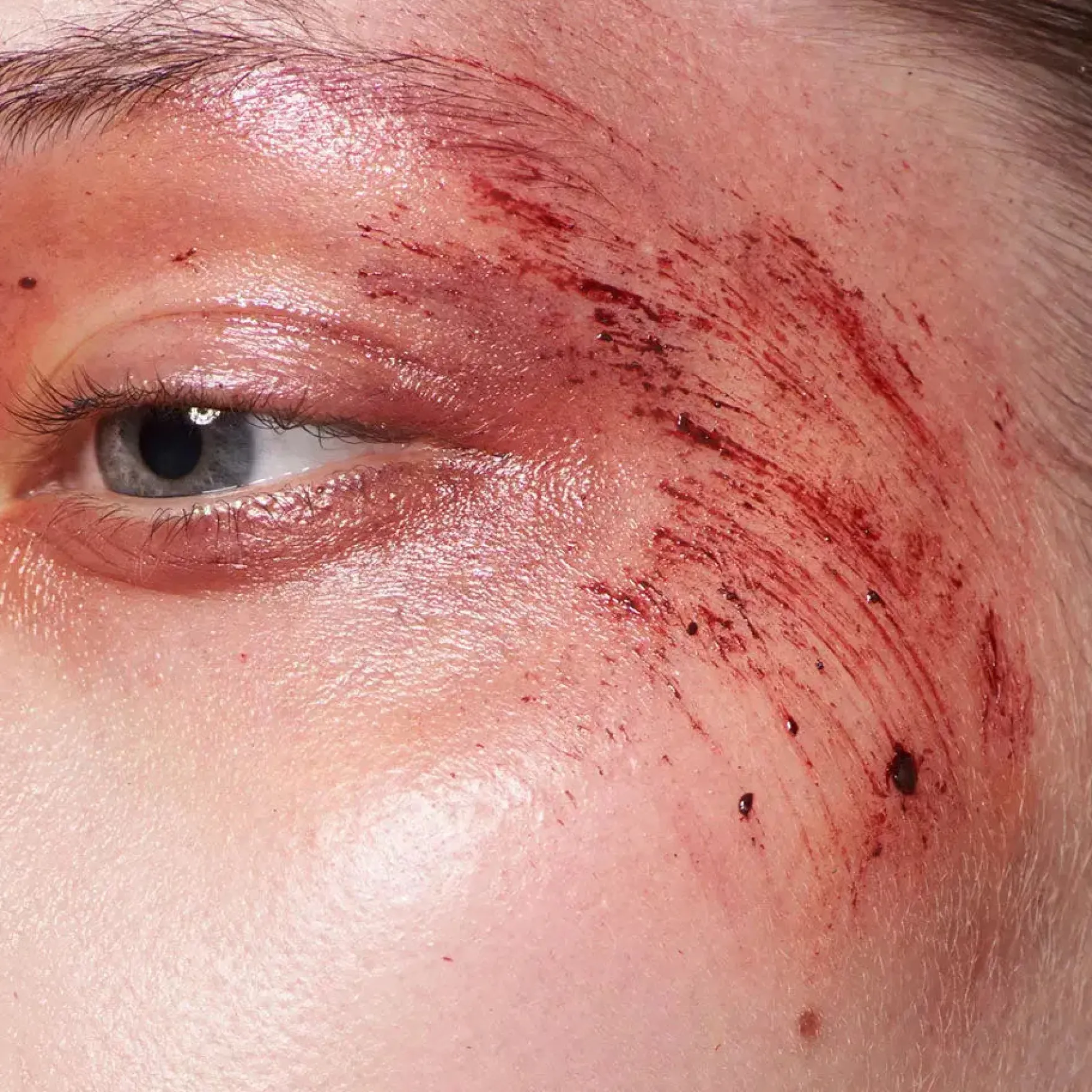 Fresh Scratch Light
