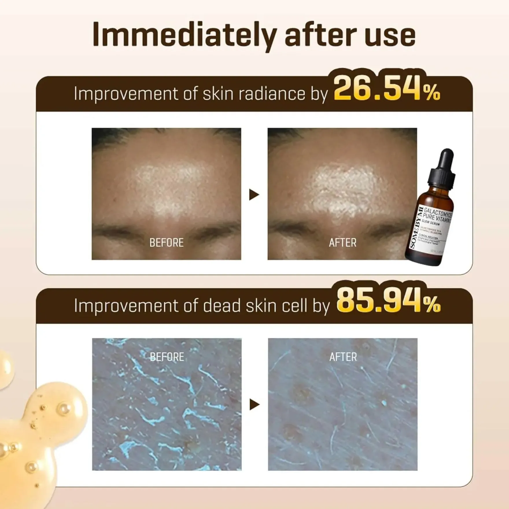 Galactomyces Pure Vitamin C Glow Serum