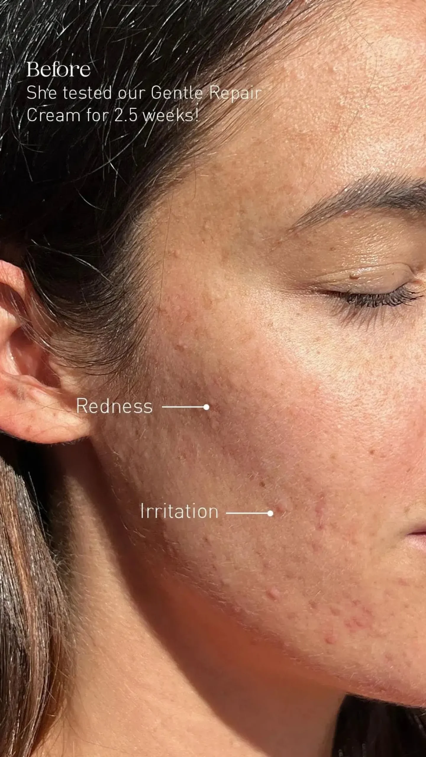 Gentle Repair Cream