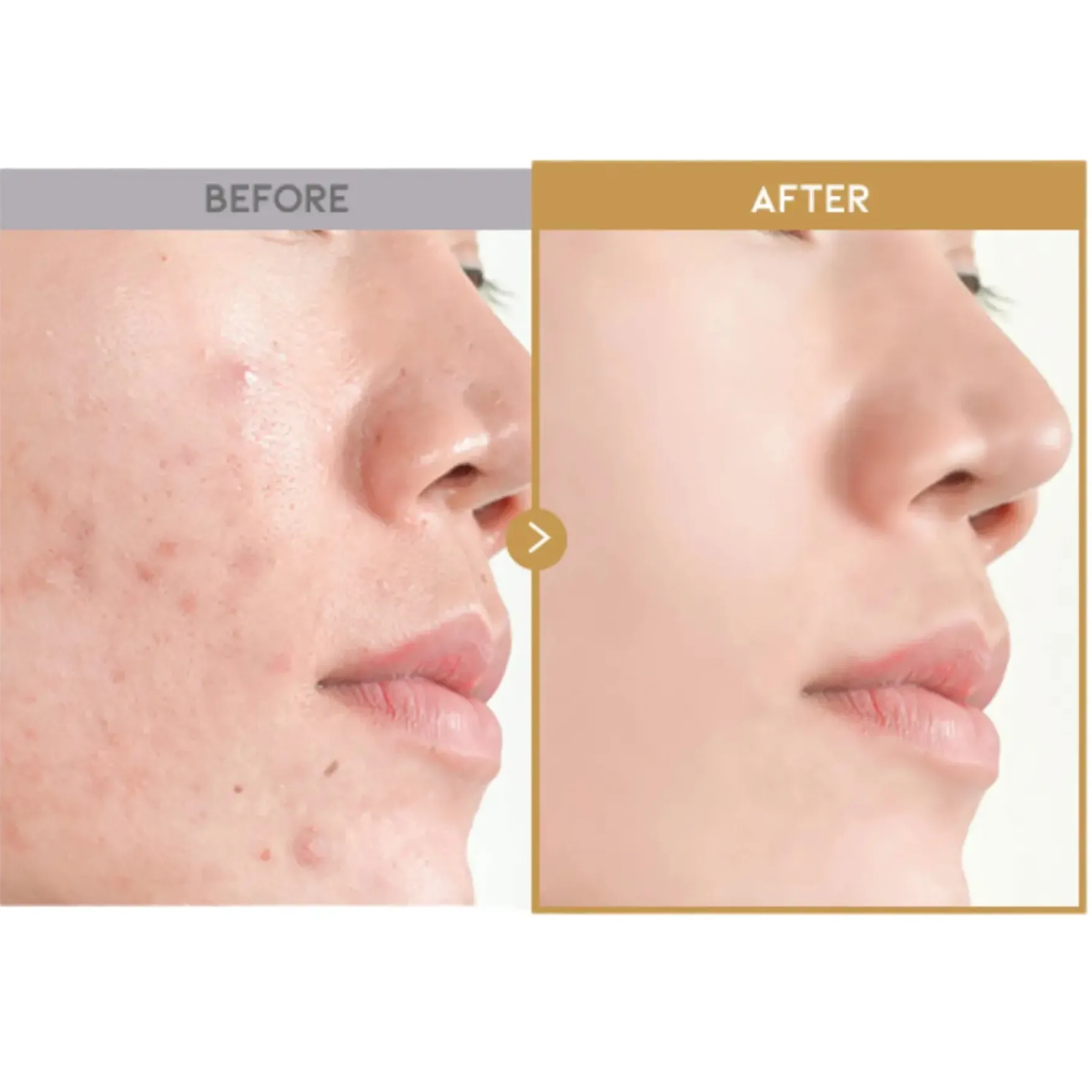 Glass Skin Rice Water Toner Pad