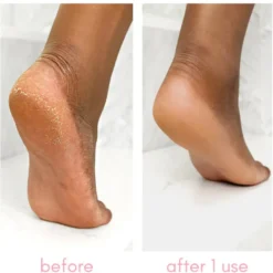 Heel-ing Callus Remover