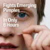 6 Hour Fast Clear Acne Patch