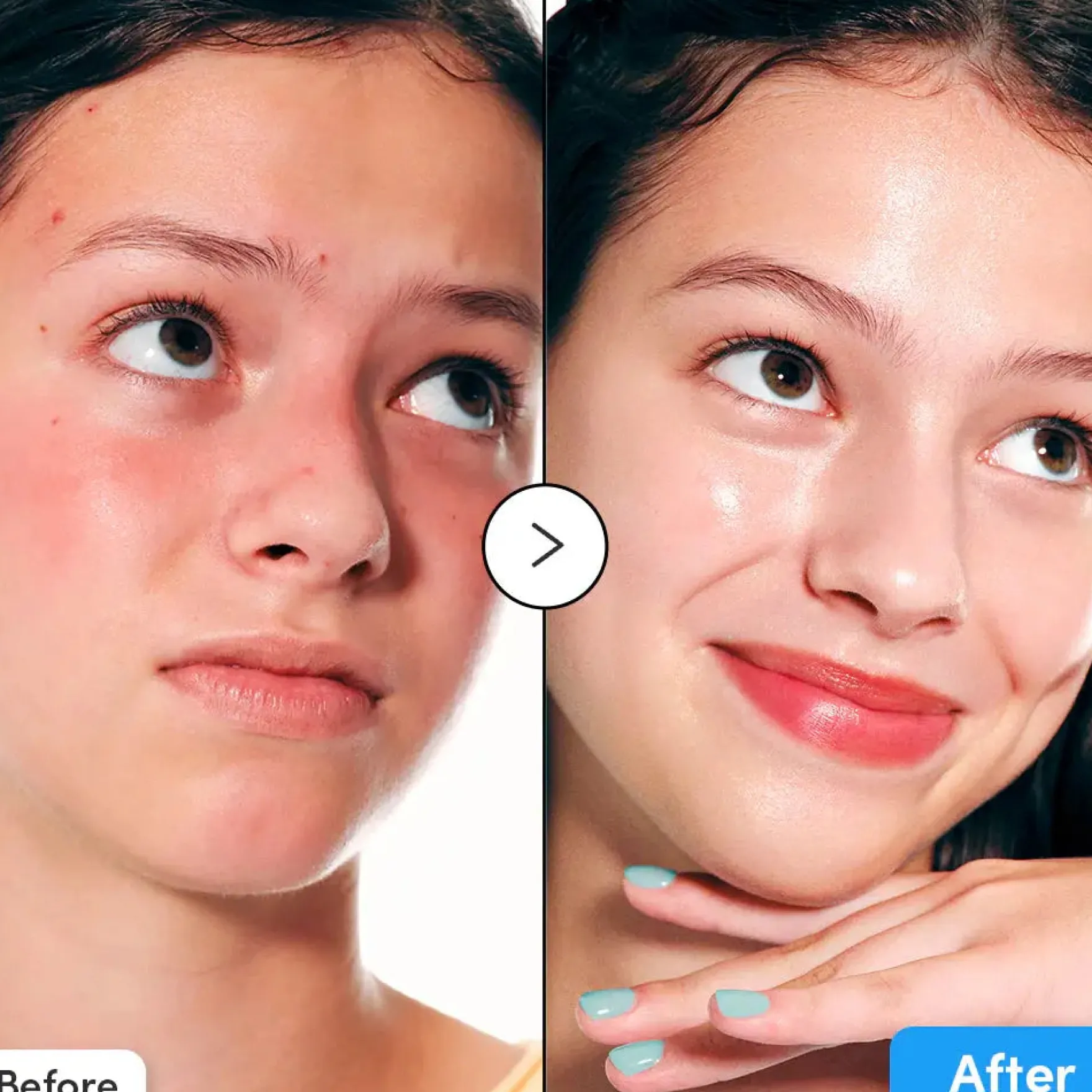 Hyaltoin Flooding Serum