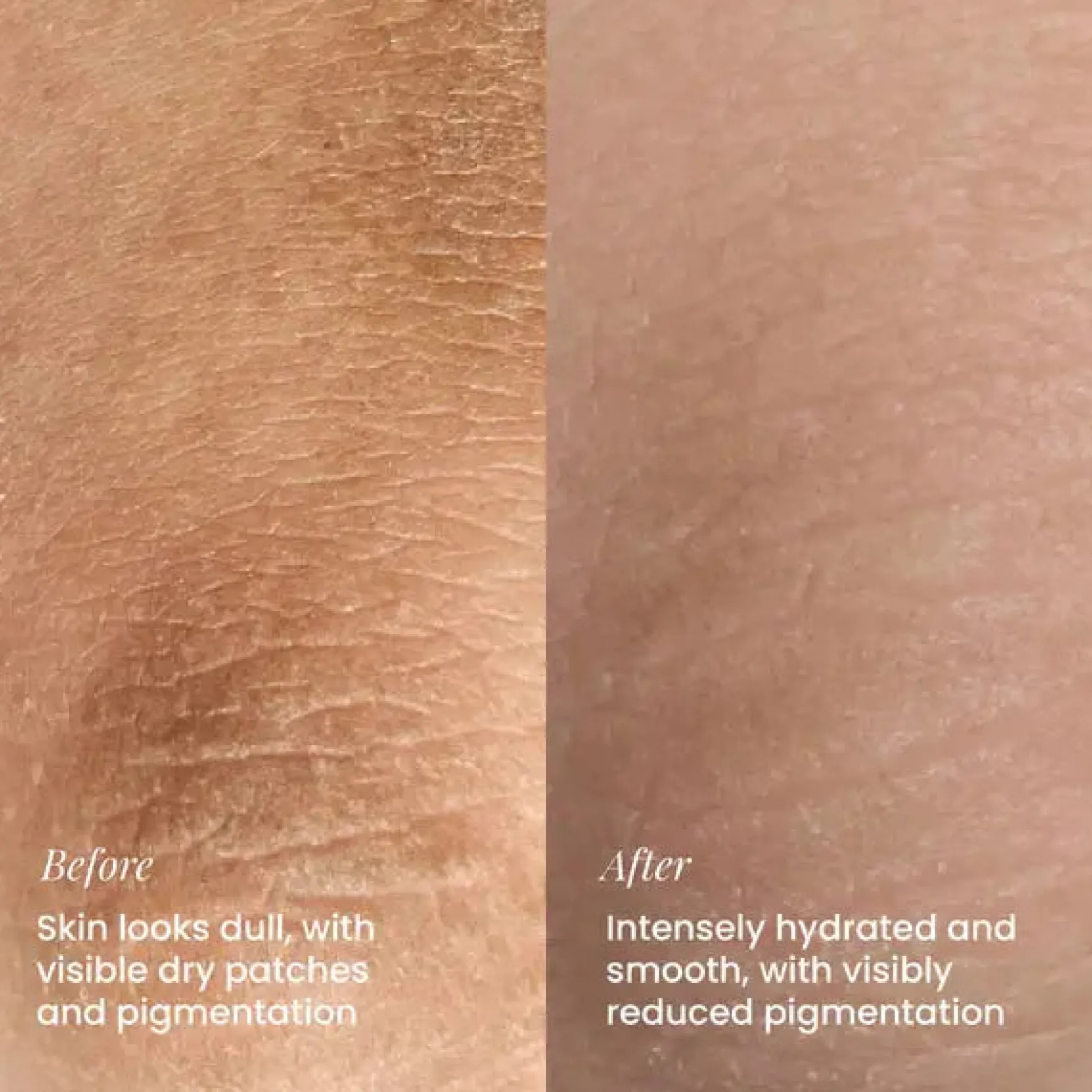 Hydrating Body Lotion
