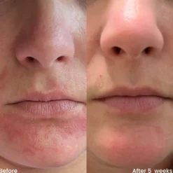 Hydrating Moisturizer