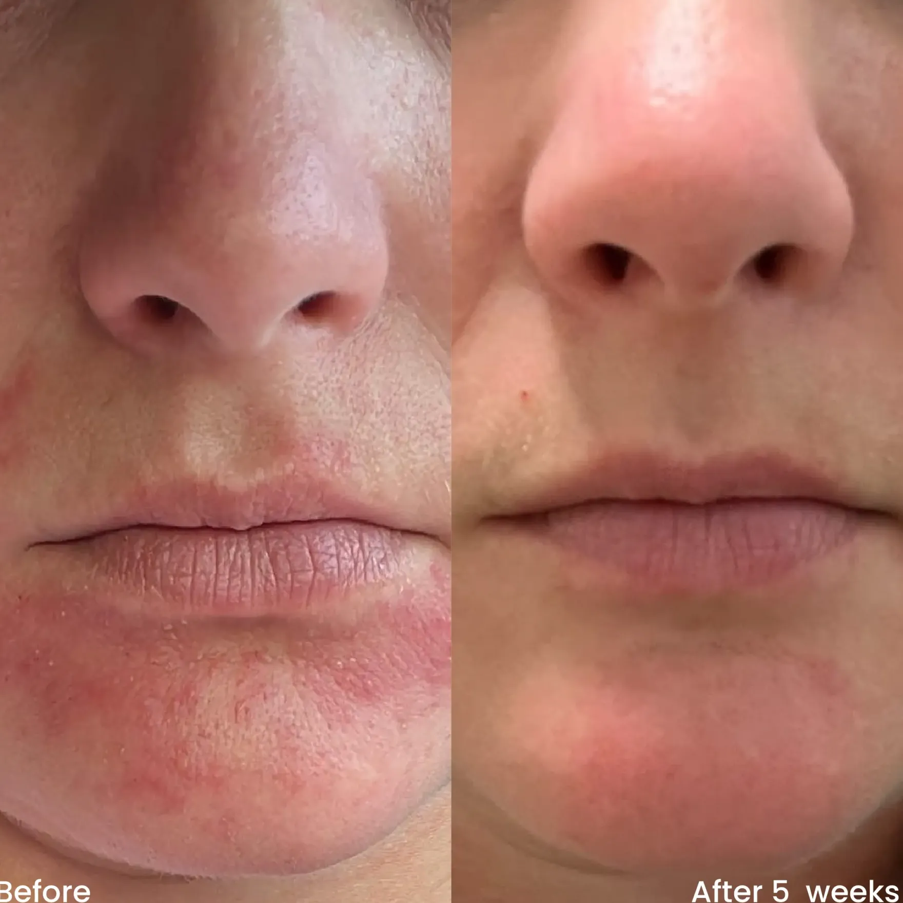 Hydrating Moisturizer