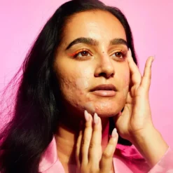Hyperpigmentation Pimple Patch