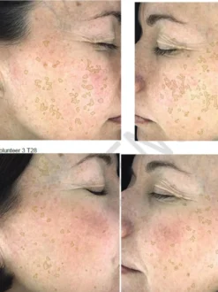 Hyperpigmentation Serum - 2% Alpha Arbutin + 1% Kojic Acid