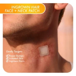Ingrown Hair Face and Neck Beard Patch