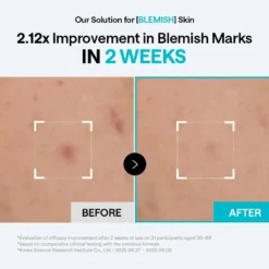 Madecassoside Blemish Pad