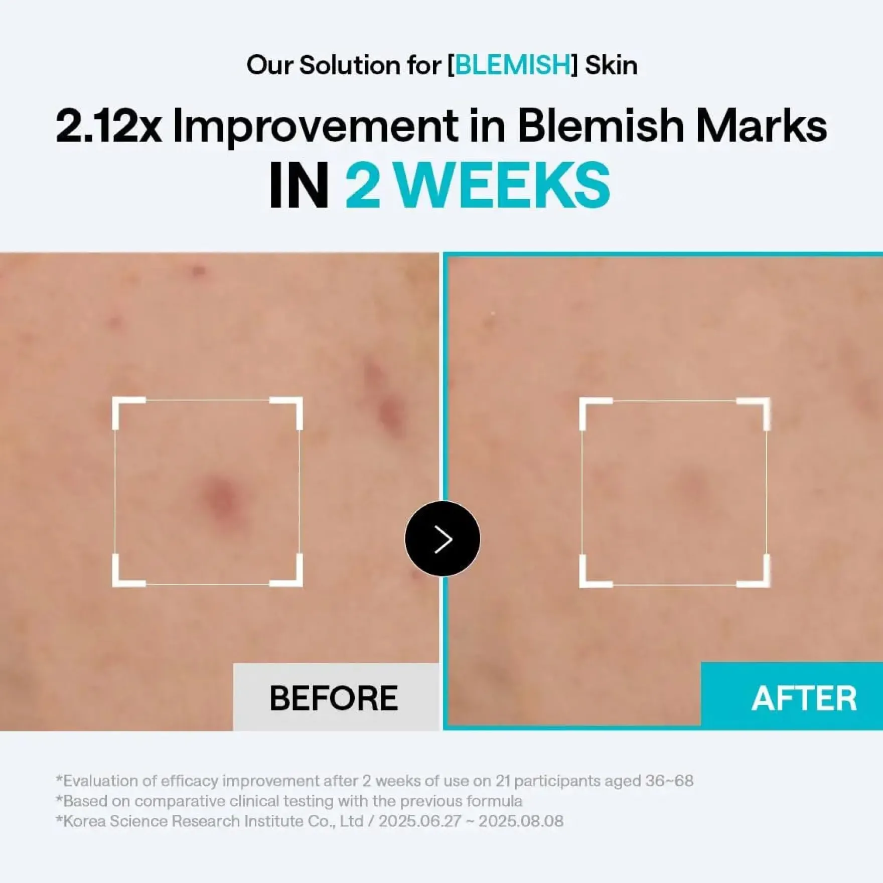 Madecassoside Blemish Pad