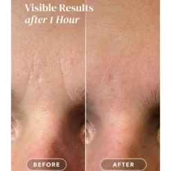 Mini Pack Facial Patches Hyaluron