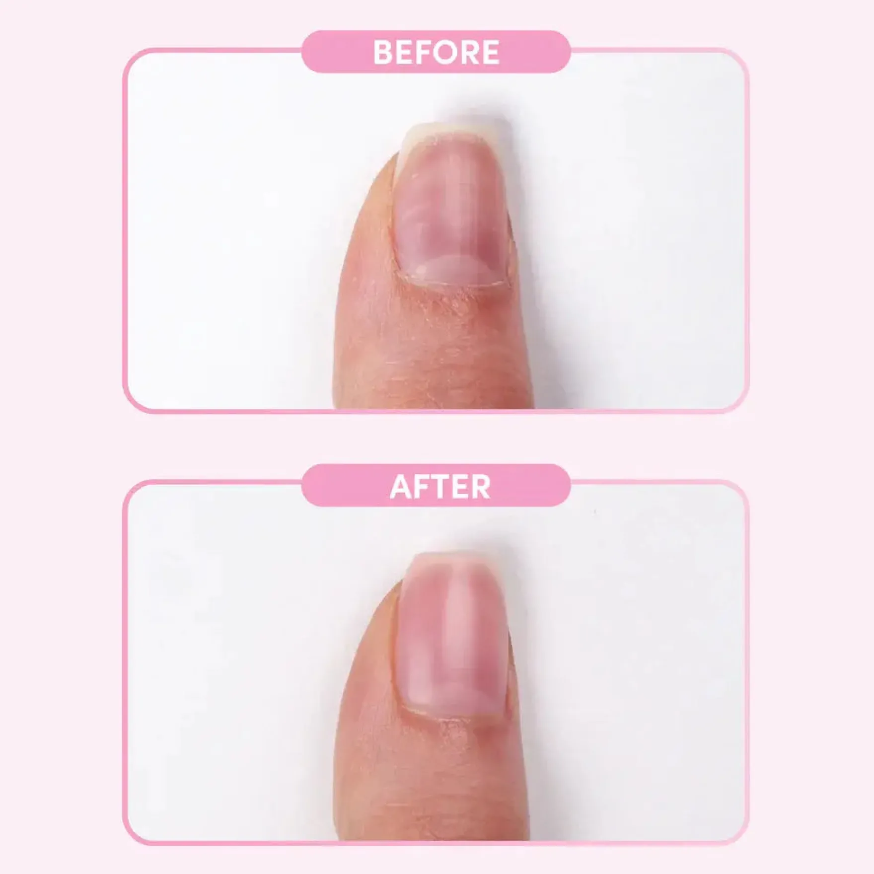 Nail Retouche Smooth + Blur