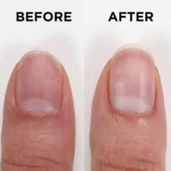 Nailtrition