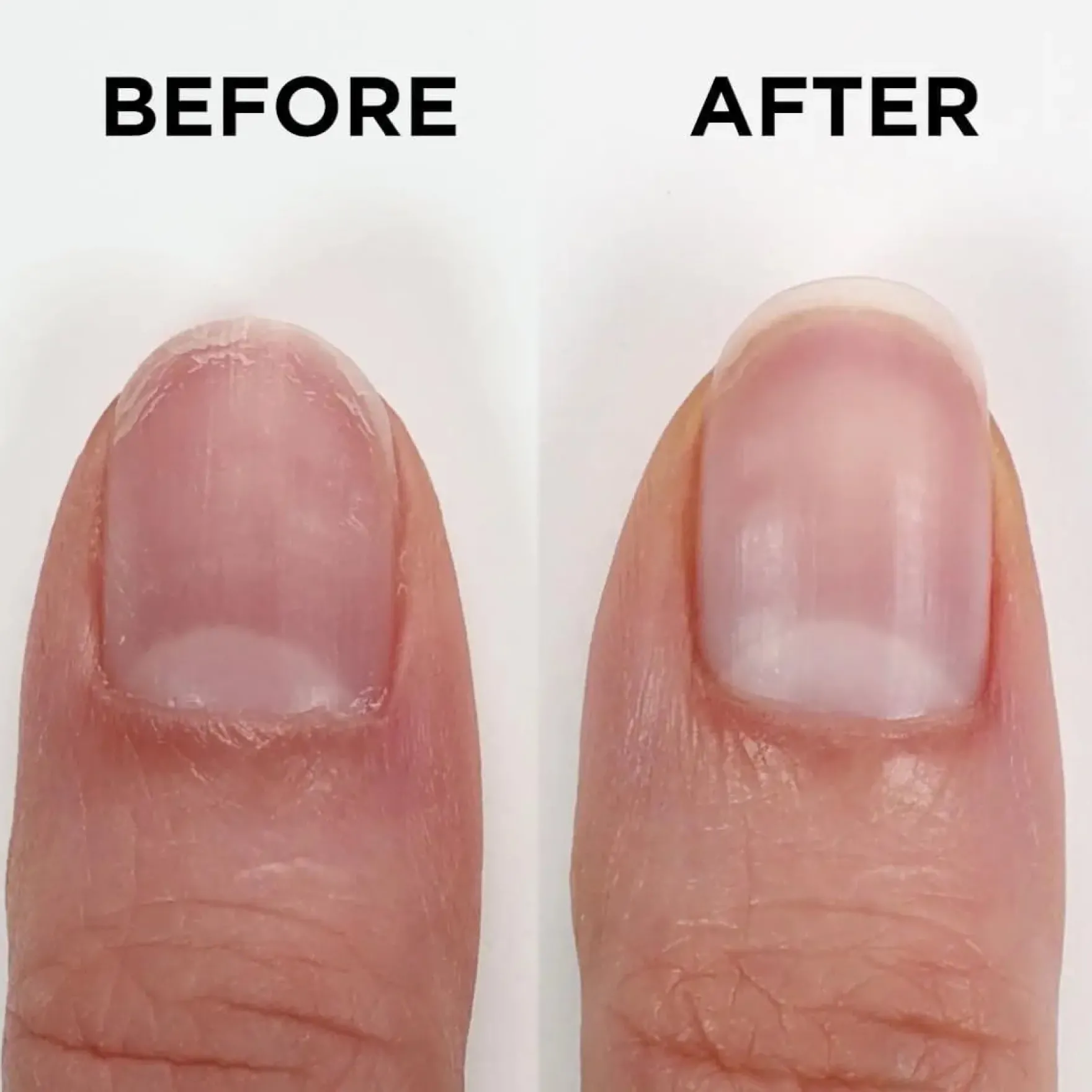 Nailtrition